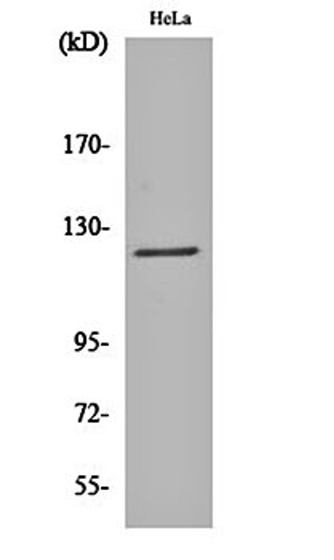 Western blot analysis of Hela cell lysates using Atrophin-1 antibody