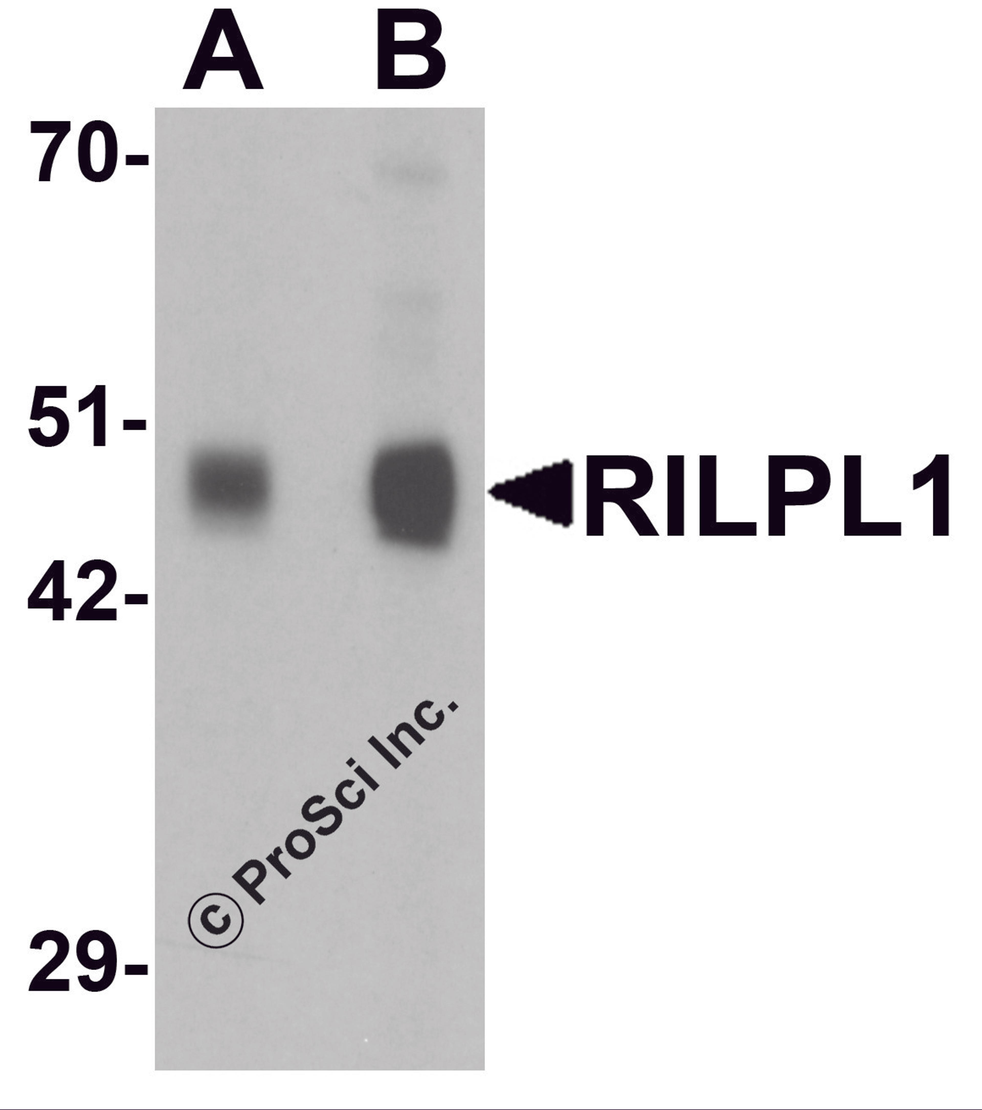 Western blot analysis of RILPL1 in rat cerebellum tissue lysate with RILPL1 antibody at (A) 0.5 and (B) 1 μg/mL.