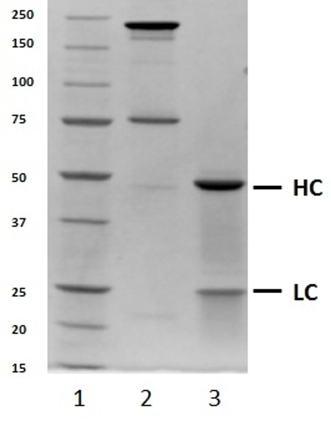 SDS-PAGE analysis of recombinant Human IgG4 lambda 