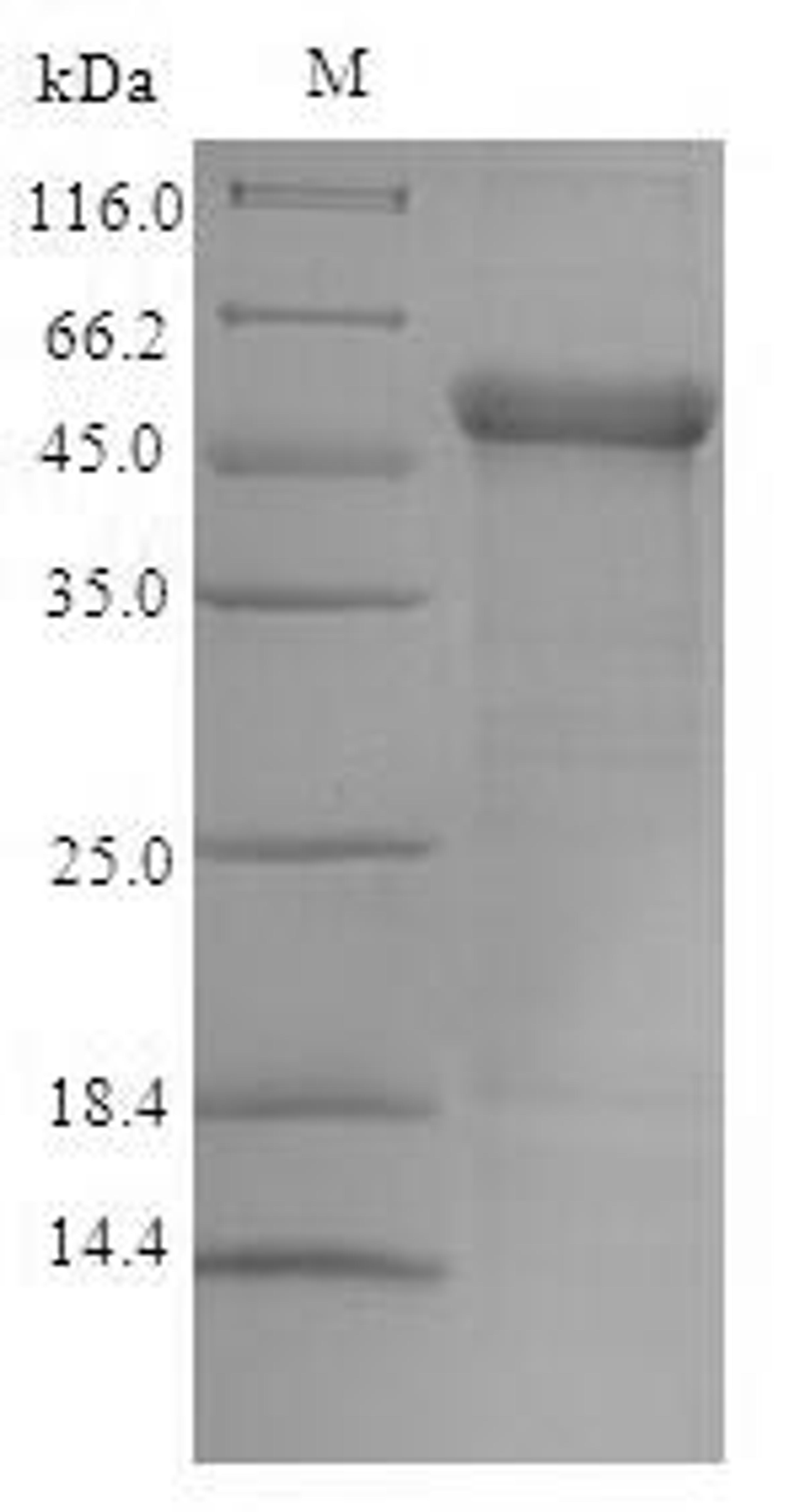 (Tris-Glycine gel) Discontinuous SDS-PAGE (reduced) with 5% enrichment gel and 15% separation gel.