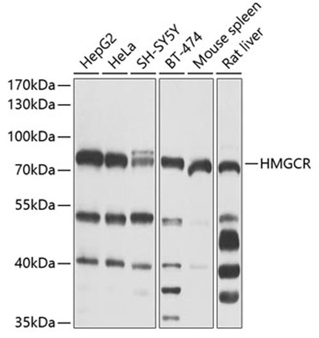 Western blot - HMGCR antibody (A1633)