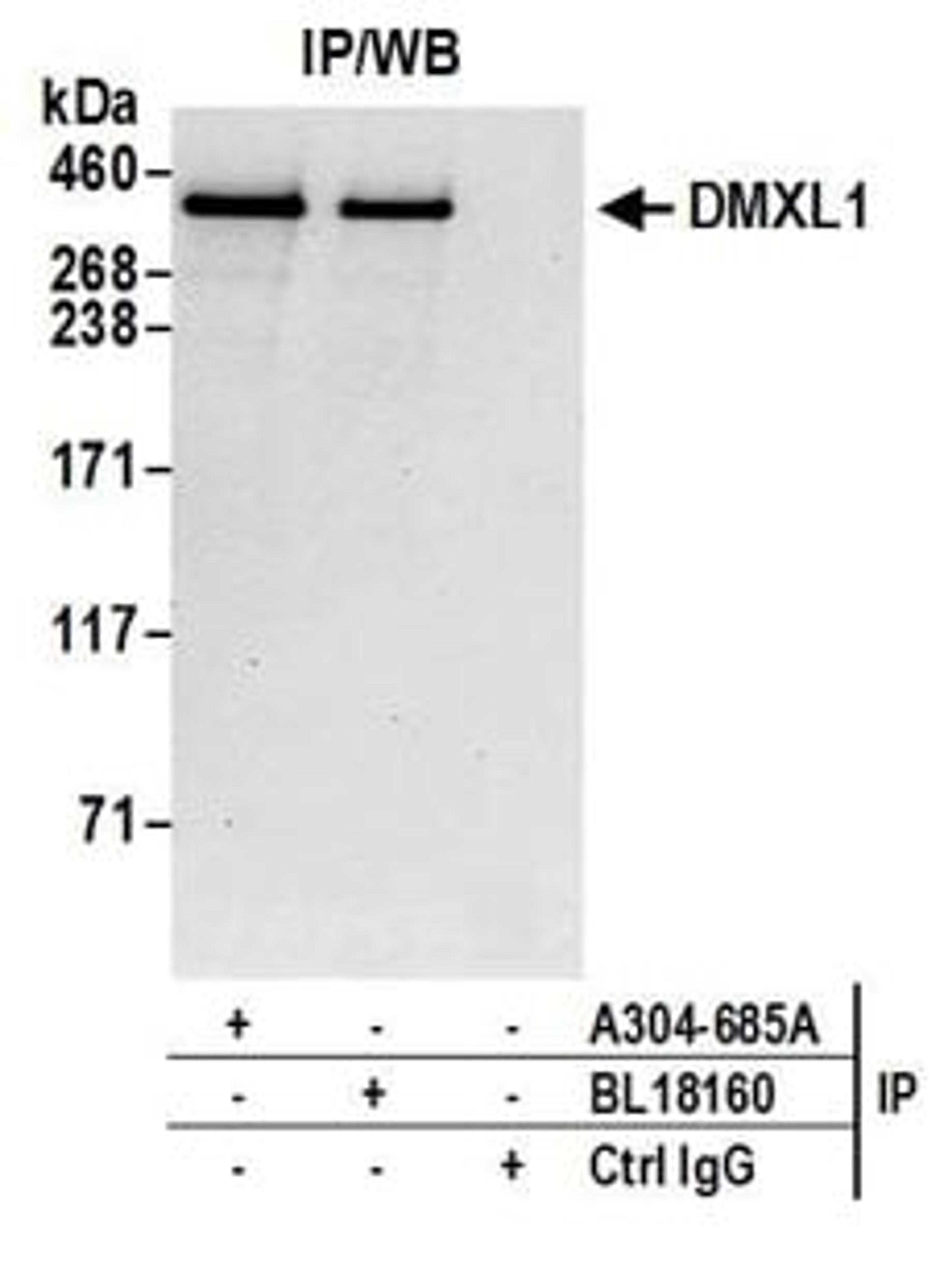 Detection of human DMXL1 by western blot of immunoprecipitates.