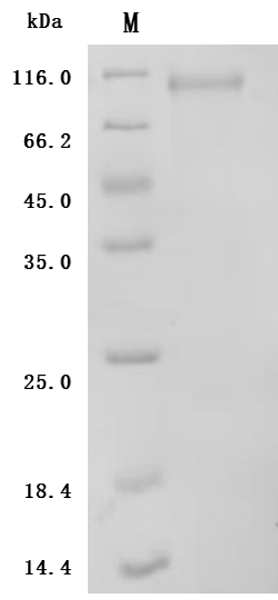 (Tris-Glycine gel) Discontinuous SDS-PAGE (reduced) with 5% enrichment gel and 15% separation gel.