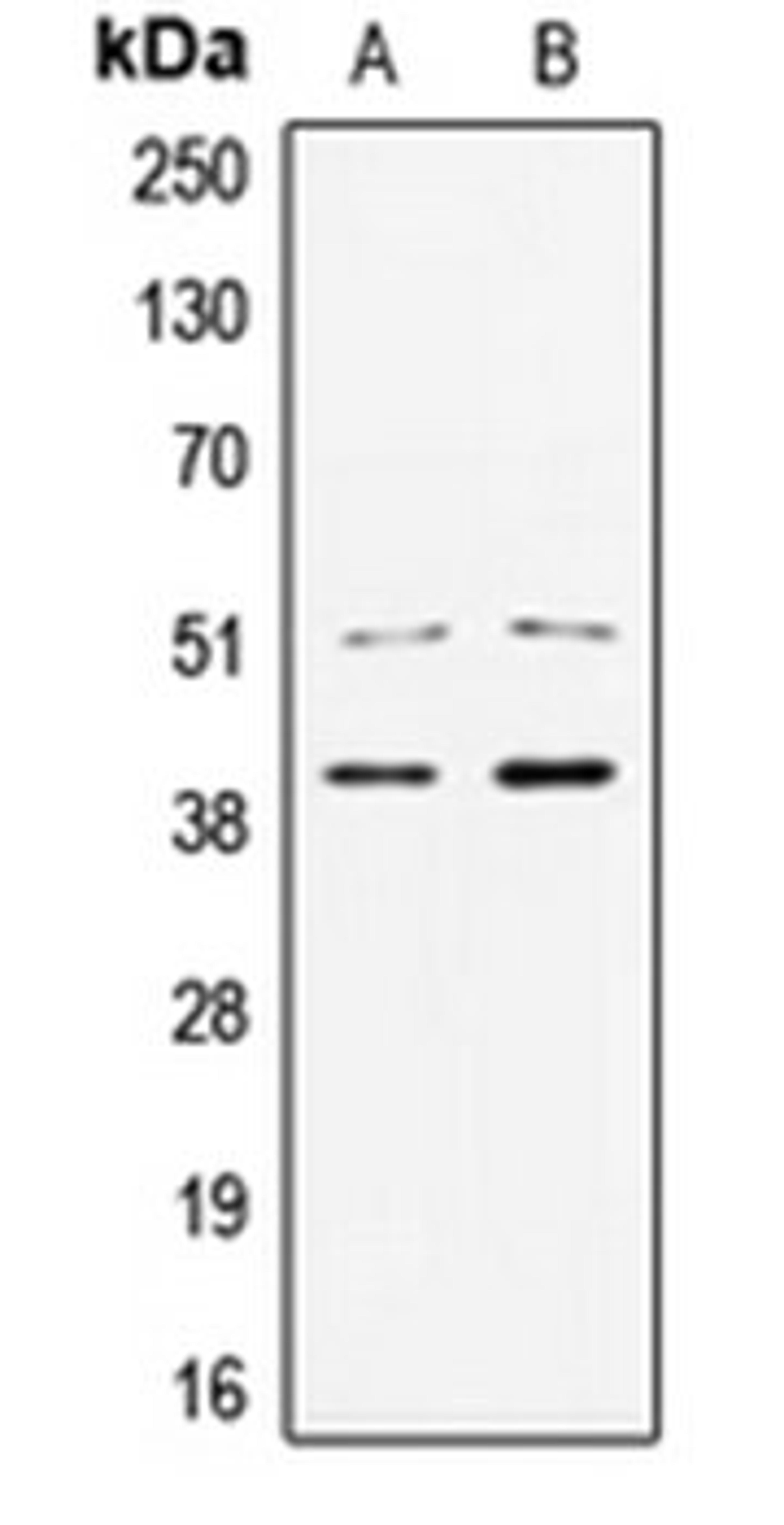 Western blot analysis of Jurkat (Lane 1), HCT29 (Lane 2) whole cell lysates using TCF7 antibody