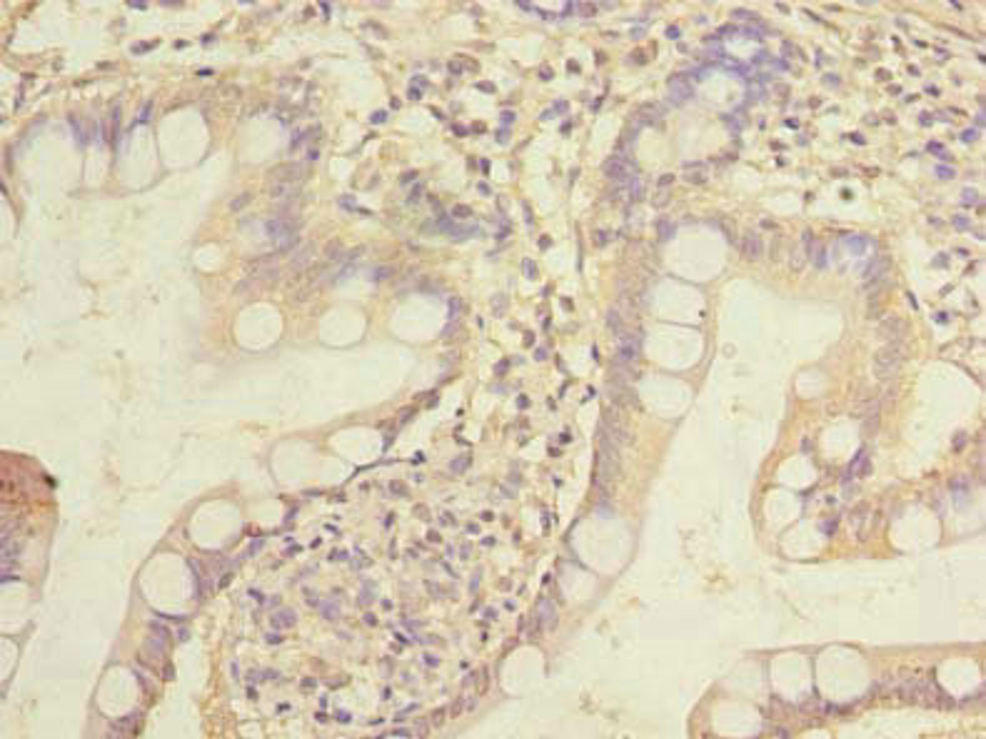 Immunohistochemistry of paraffin-embedded human small intestine tissue using CSB-PA010672LA01HU at dilution of 1:100