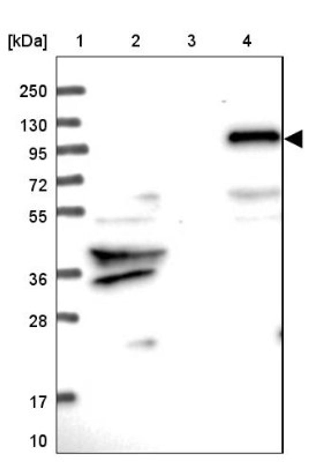 Western Blot: ZNF438 Antibody [NBP1-88797] - Lane 1: Marker [kDa] 250, 130, 95, 72, 55, 36, 28, 17, 10<br/>Lane 2: Human cell line RT-4<br/>Lane 3: Human cell line U-251MG sp<br/>Lane 4: Human plasma (IgG/HSA depleted)