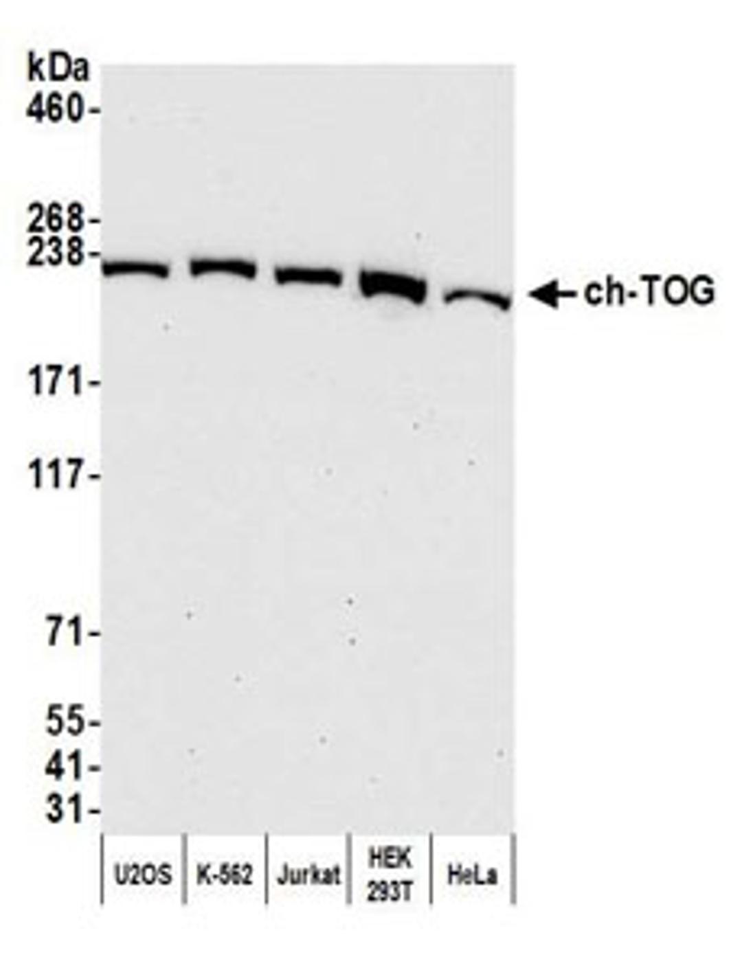 Detection of human ch-TOG by western blot.