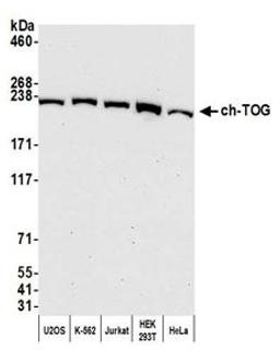 Detection of human ch-TOG by western blot.