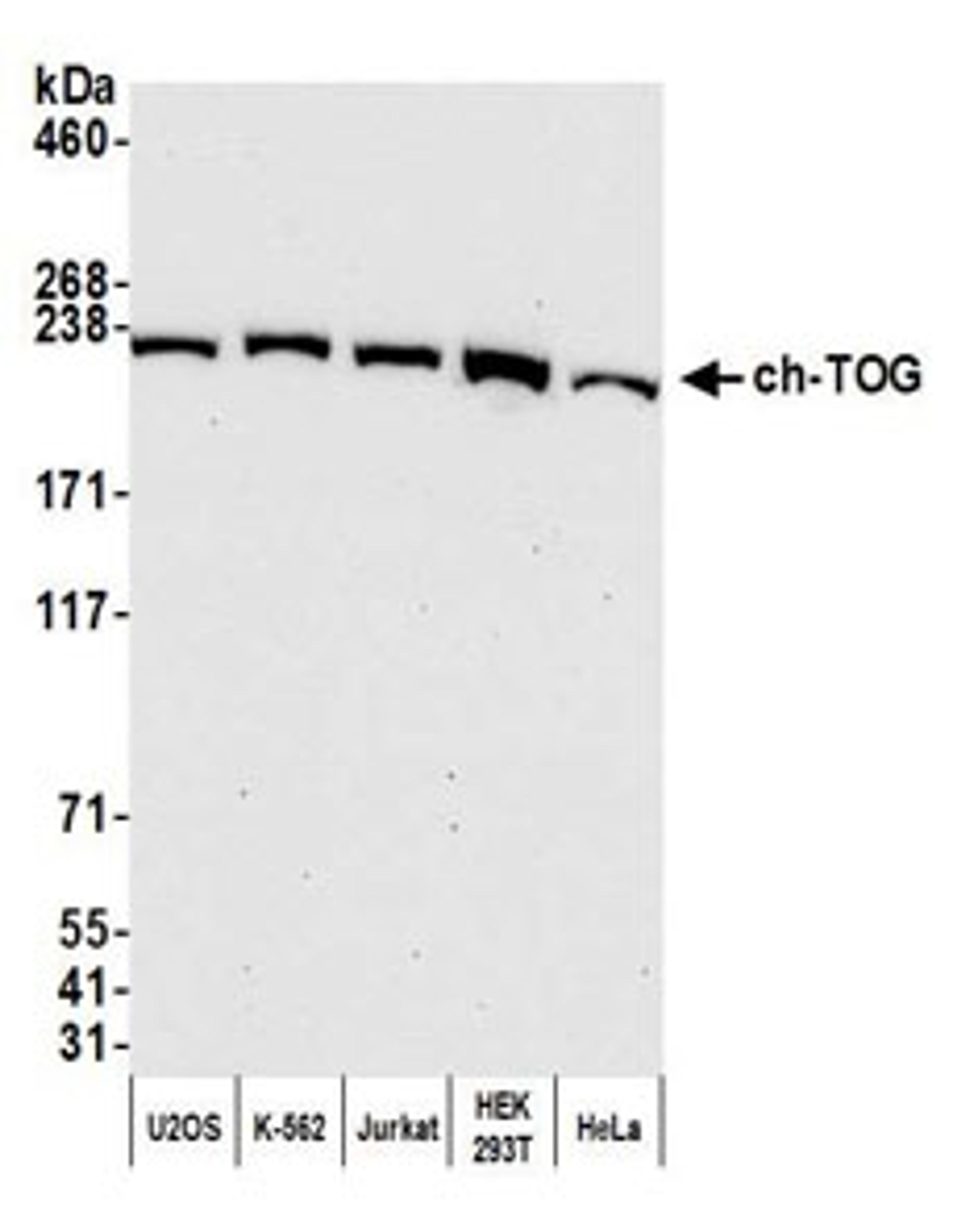 Detection of human ch-TOG by western blot.