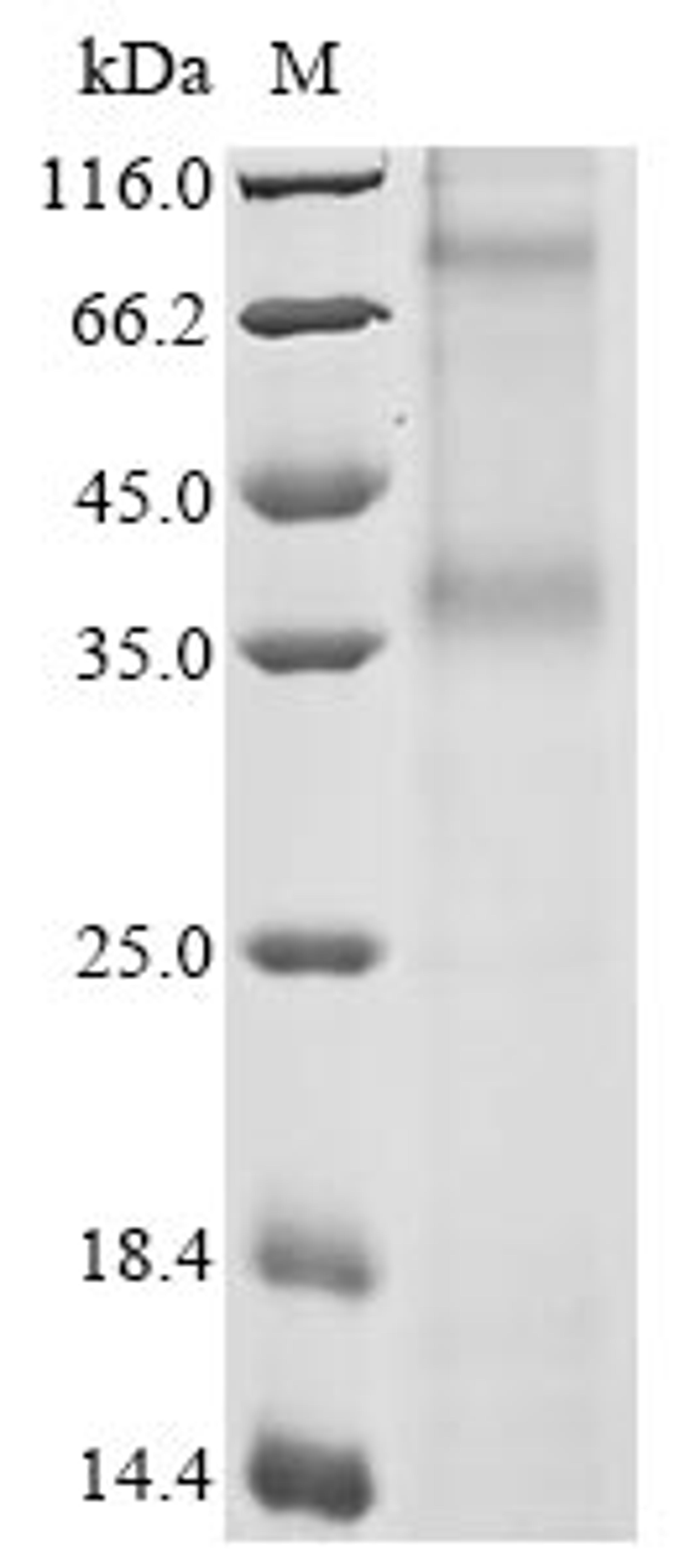 (Tris-Glycine gel) Discontinuous SDS-PAGE (reduced) with 5% enrichment gel and 15% separation gel.
