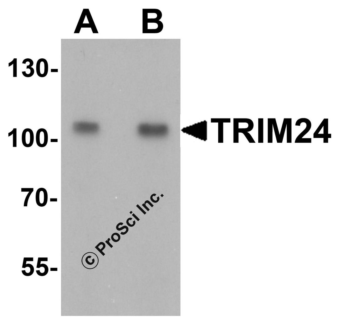 Western blot analysis of TRIM24 in A431 cell lysate with TRIM24 antibody at (A) 0.5 and (B) 1 μg/mL.