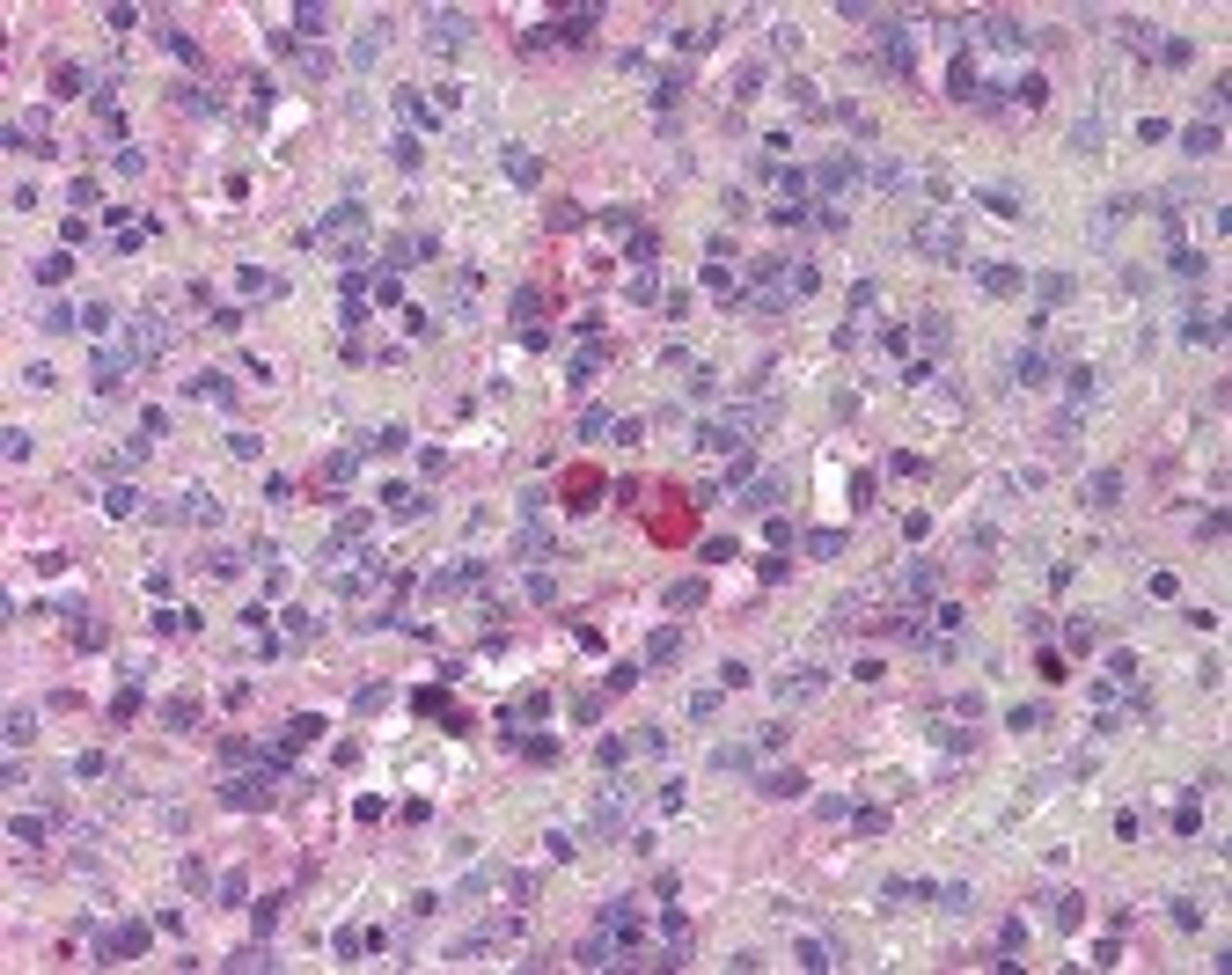 Immunohistochemistry staining of Thrombopoietin in spleen tissue using Thrombopoietin Antibody.