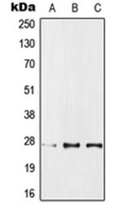 Western blot analysis of MCF7 (Lane 1), SP2/0 (Lane 2), PC12 (Lane 3) whole cell lysates using PPP1R1A antibody