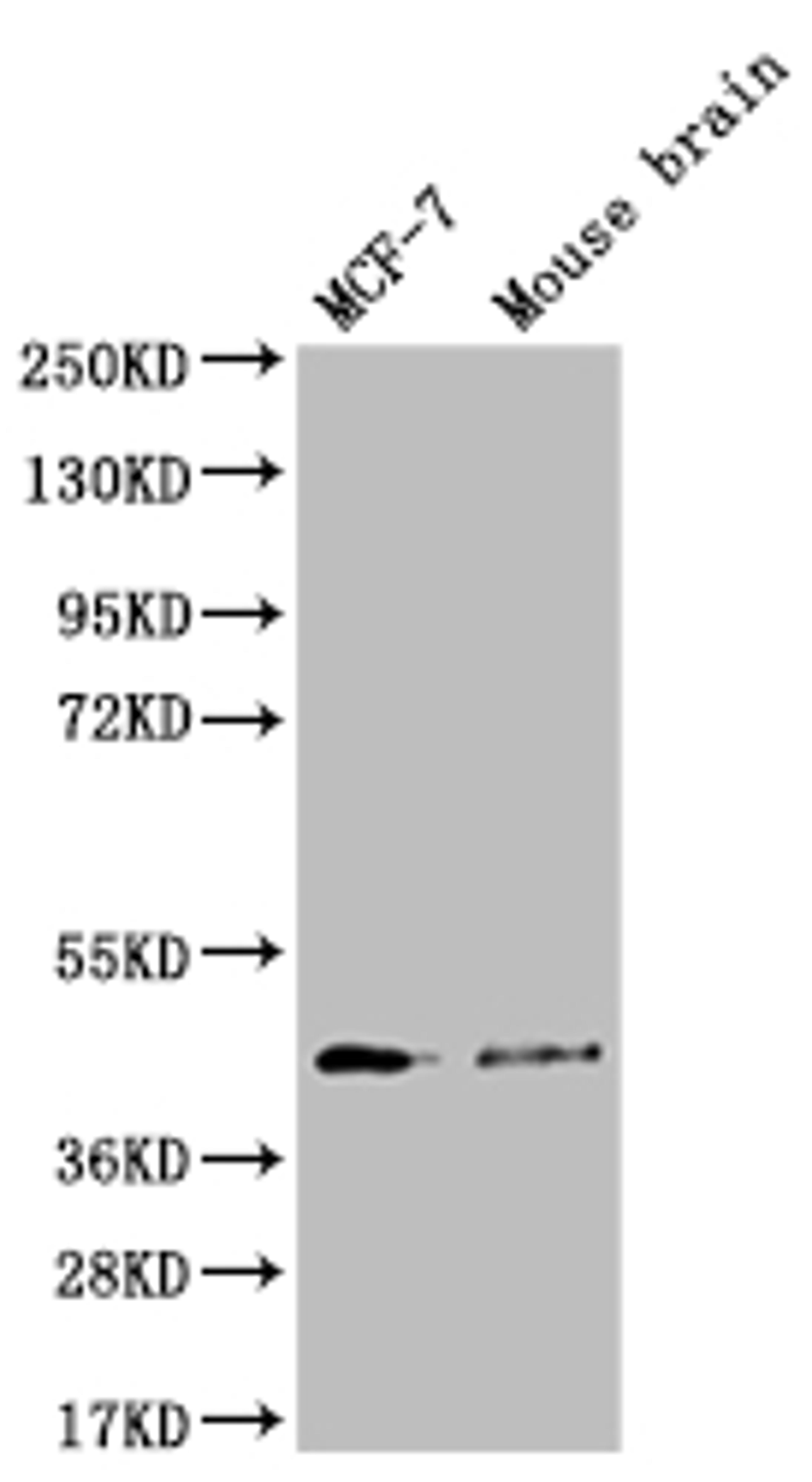 Western Blot. Positive WB detected in: MCF-7 whole cell lysate, Mouse brain tissue. All lanes: SLC27A4 antibody at 1:1000. Secondary. Goat polyclonal to rabbit IgG at 1/50000 dilution. Predicted band size: 73, 27 kDa. Observed band size: 42 kDa.