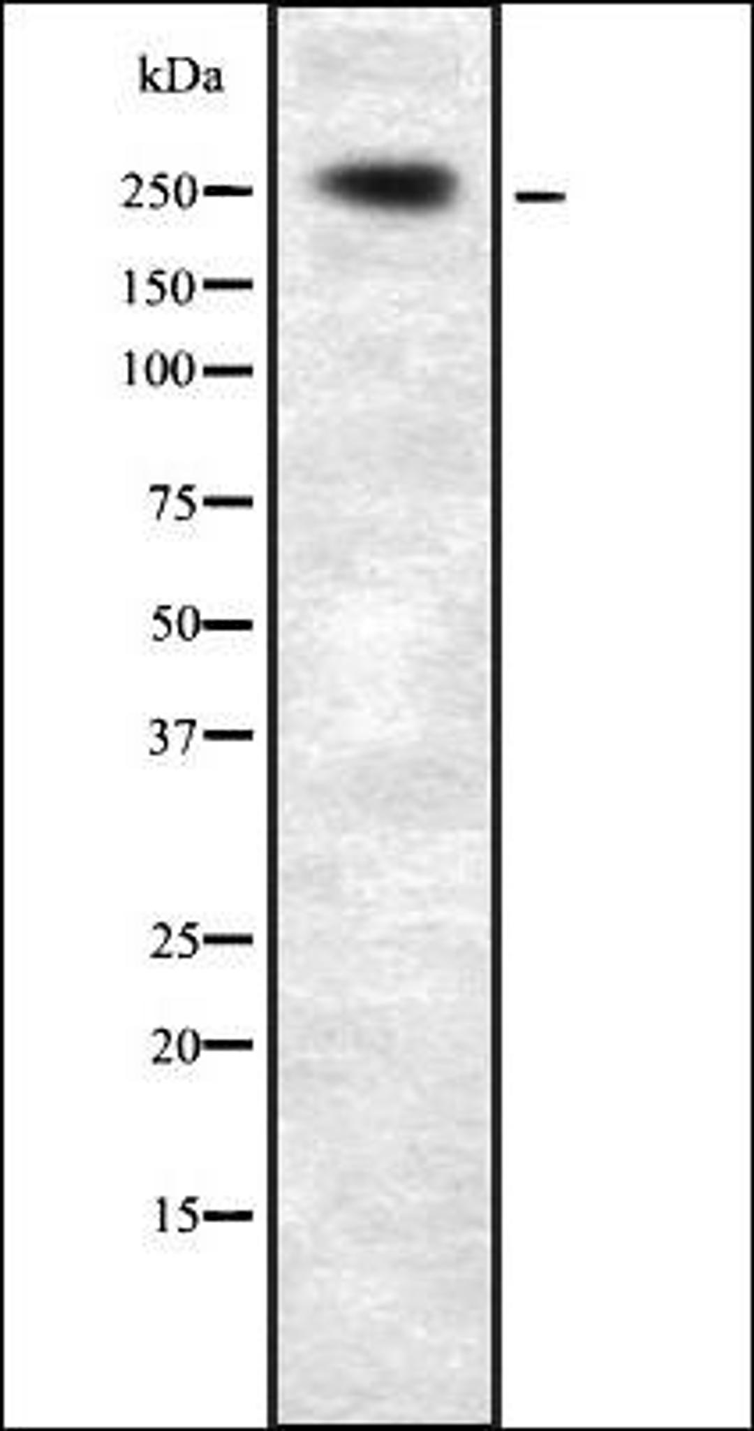 Western blot analysis of HEK293 cells using PLCE1 antibody