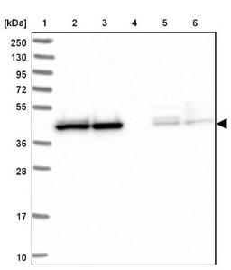 Western Blot: HOMER3 Antibody [NBP2-32607] - Lane 1: Marker [kDa] 250, 130, 95, 72, 55, 36, 28, 17, 10<br/>Lane 2: Human cell line RT-4<br/>Lane 3: Human cell line U-251MG sp<br/>Lane 4: Human plasma (IgG/HSA depleted)<br/>Lane 5: Human liver tissue<br/>Lane 6: Human tonsil tissue