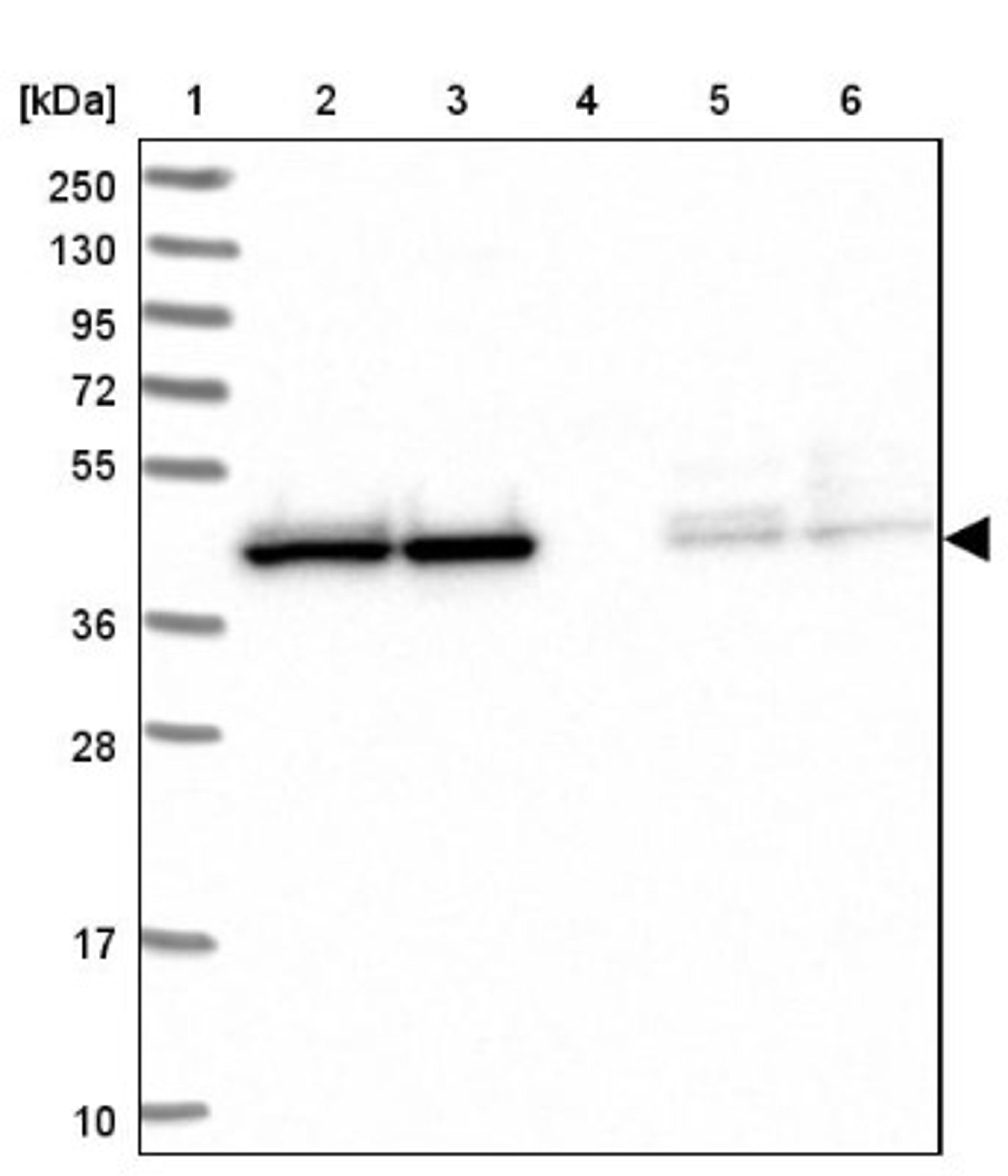 Western Blot: HOMER3 Antibody [NBP2-32607] - Lane 1: Marker [kDa] 250, 130, 95, 72, 55, 36, 28, 17, 10<br/>Lane 2: Human cell line RT-4<br/>Lane 3: Human cell line U-251MG sp<br/>Lane 4: Human plasma (IgG/HSA depleted)<br/>Lane 5: Human liver tissue<br/>Lane 6: Human tonsil tissue