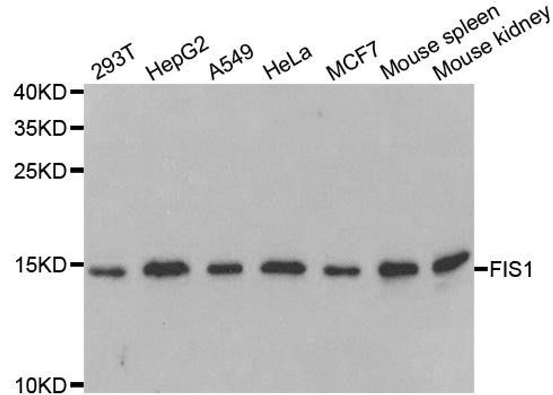 Western blot analysis of extracts of various cell lines using FIS1 antibody