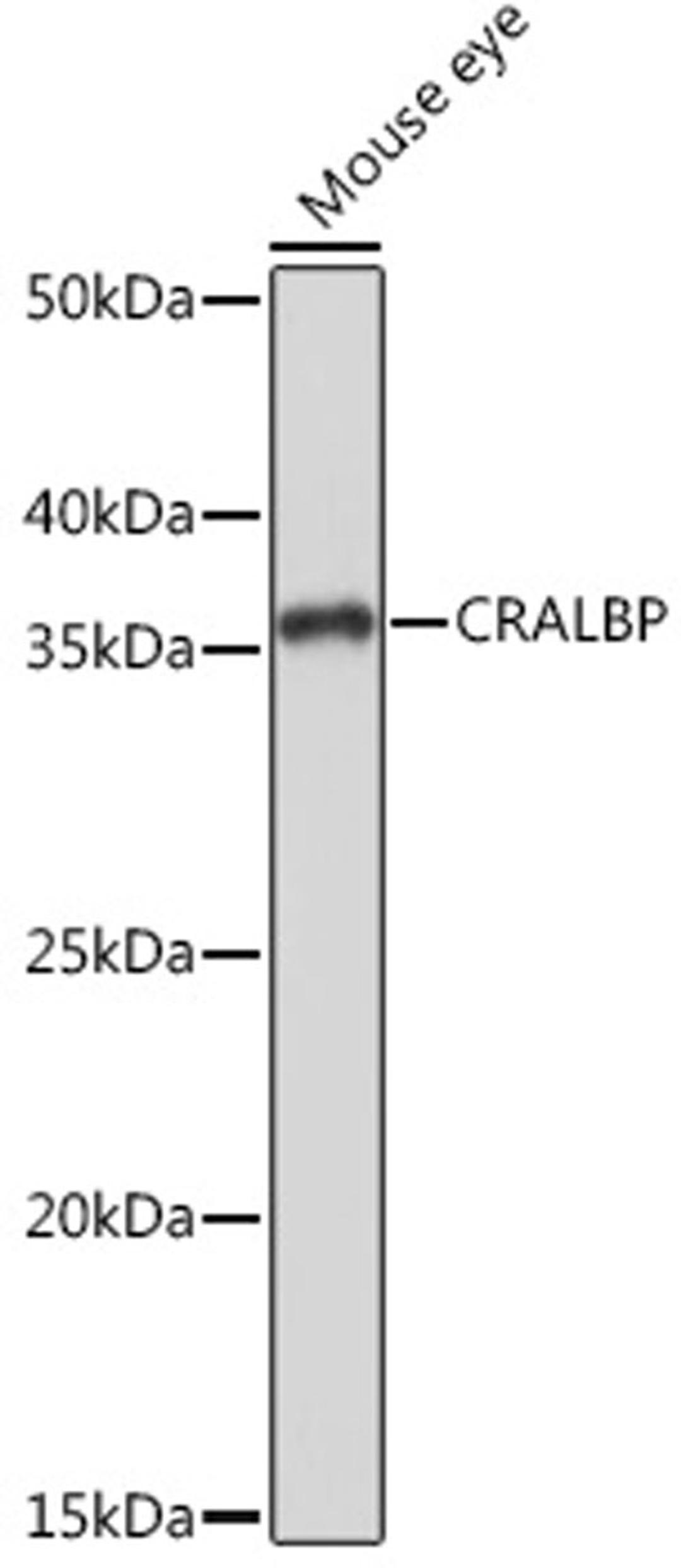 Western blot - CRALBP Rabbit mAb (A9265)