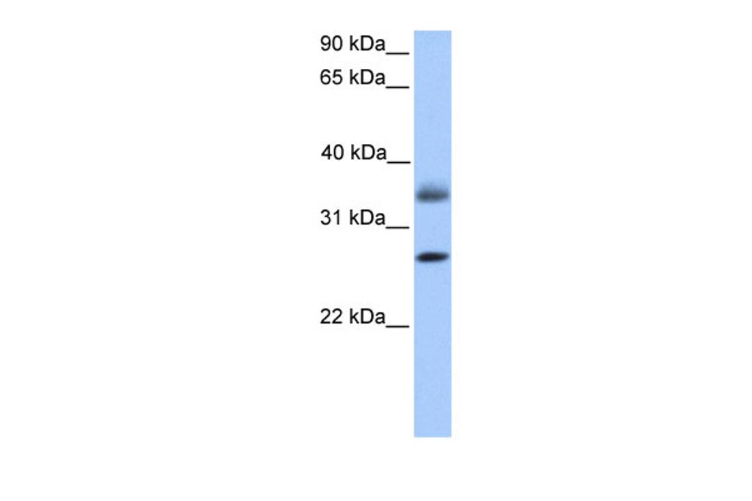 Antibody used in WB on Human HeLa at 0.2-1 ug/ml.