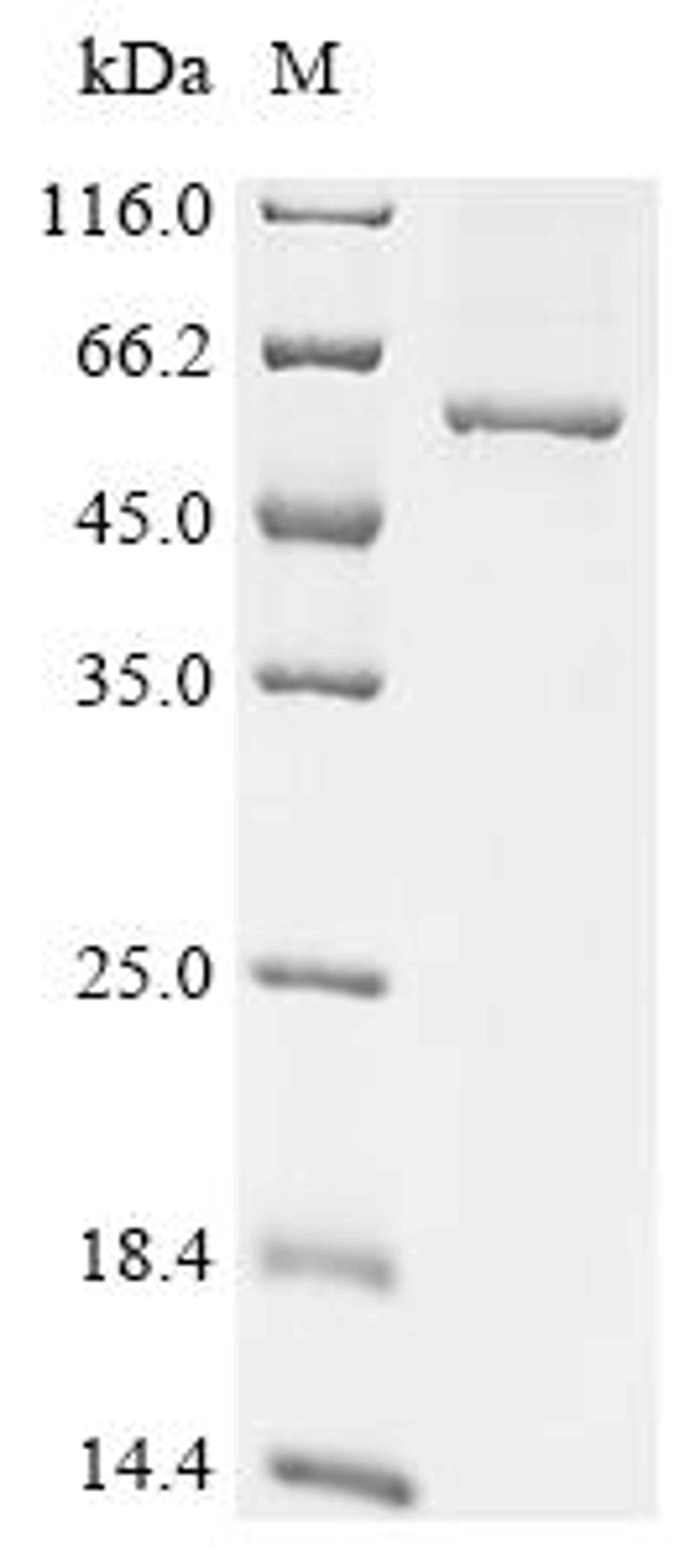 (Tris-Glycine gel) Discontinuous SDS-PAGE (reduced) with 5% enrichment gel and 15% separation gel.