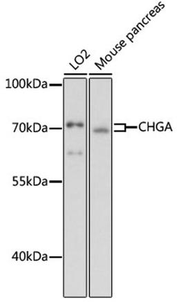 Western blot - CHGA antibody (A1668)