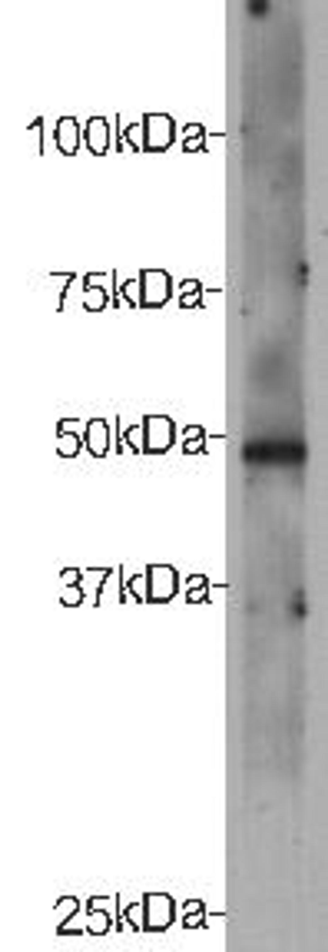 Western Blot analysis of recombinant protein of CELSR2 using Cadherin EGF LAG seven-pass G-ype Receptor 2 antibody