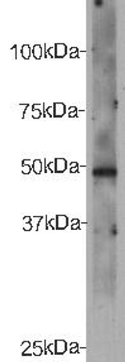 Western Blot analysis of recombinant protein of CELSR2 using Cadherin EGF LAG seven-pass G-ype Receptor 2 antibody