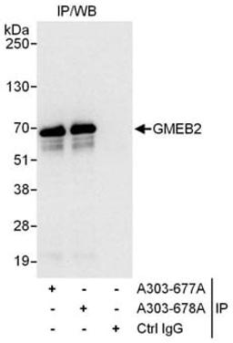 Detection of human GMEB2 by western blot of immunoprecipitates.