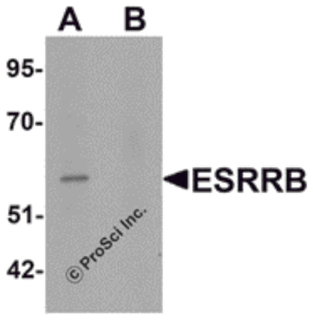 Western blot analysis of ESRRB in human heart tissue lysate with ESRRB antibody at 1 &#956;g/mL in (A) the absence and (B) the presence of blocking peptide.