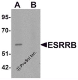 Western blot analysis of ESRRB in human heart tissue lysate with ESRRB antibody at 1 &#956;g/mL in (A) the absence and (B) the presence of blocking peptide.