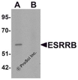 Western blot analysis of ESRRB in human heart tissue lysate with ESRRB antibody at 1 μg/mL in (A) the absence and (B) the presence of blocking peptide.