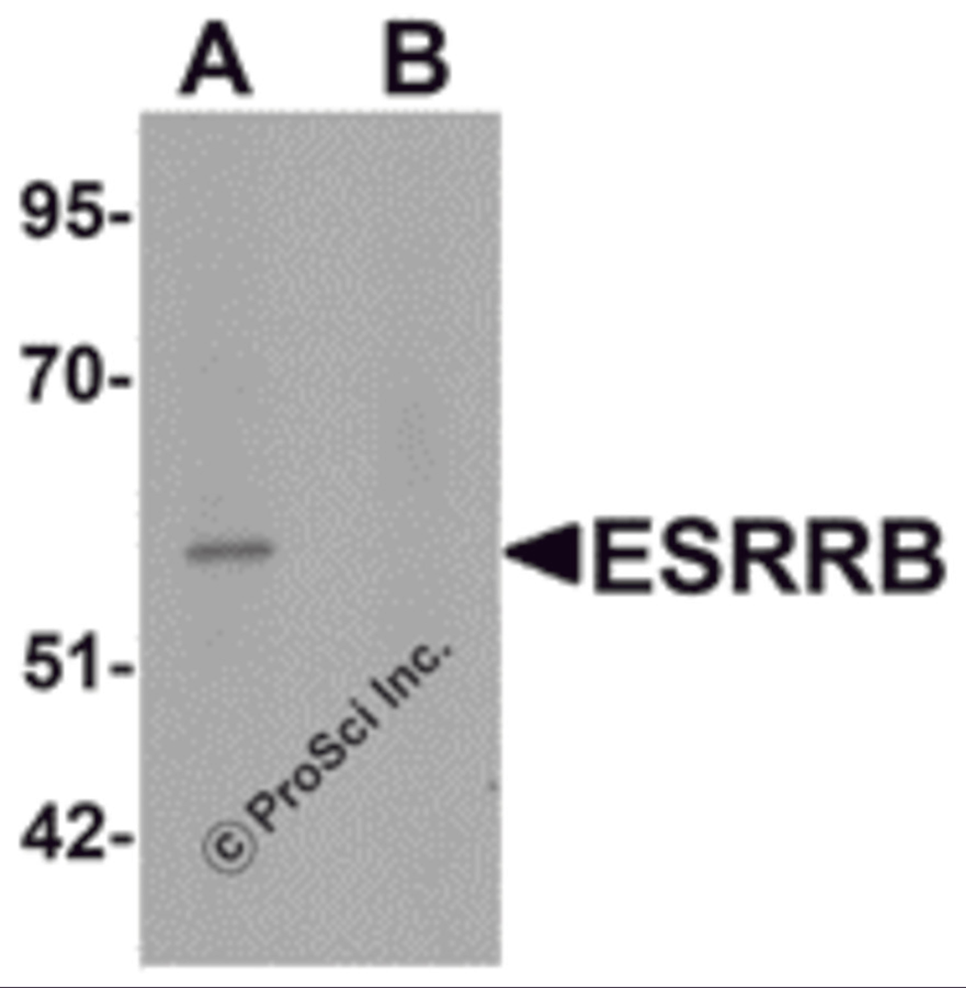 Western blot analysis of ESRRB in human heart tissue lysate with ESRRB antibody at 1 μg/mL in (A) the absence and (B) the presence of blocking peptide.