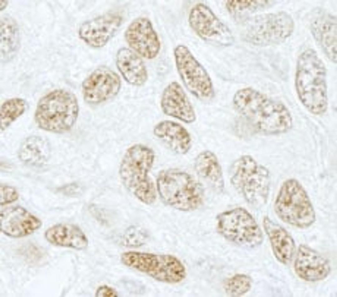 Detection of human SF3b155/SAP155 by immunohistochemistry.