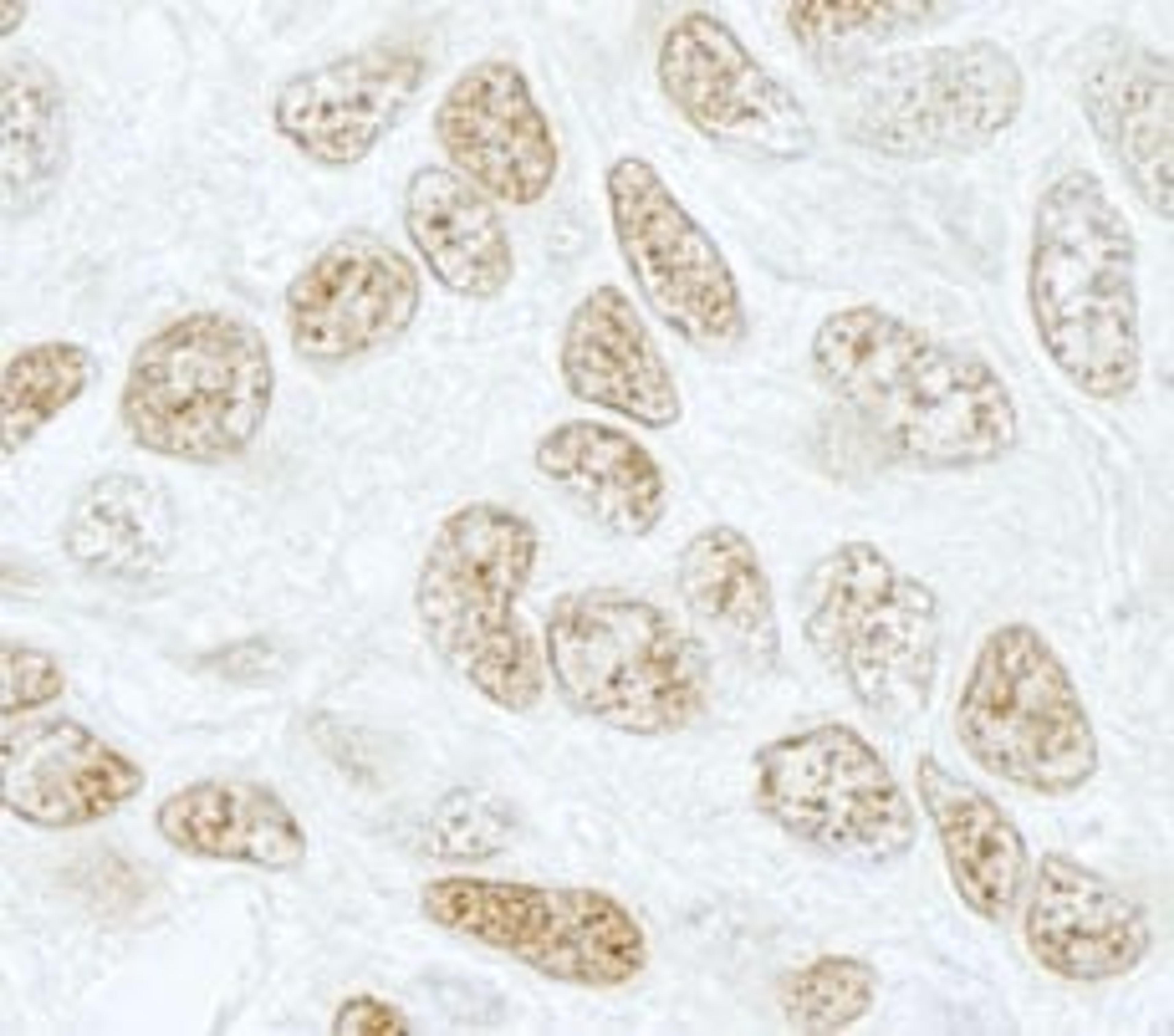 Detection of human SF3b155/SAP155 by immunohistochemistry.