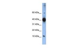 Antibody used in WB on Human Jurkat cells at 0.2-1 ug/ml.