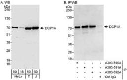 Detection of human DCP1A by western blot and immunoprecipitation.