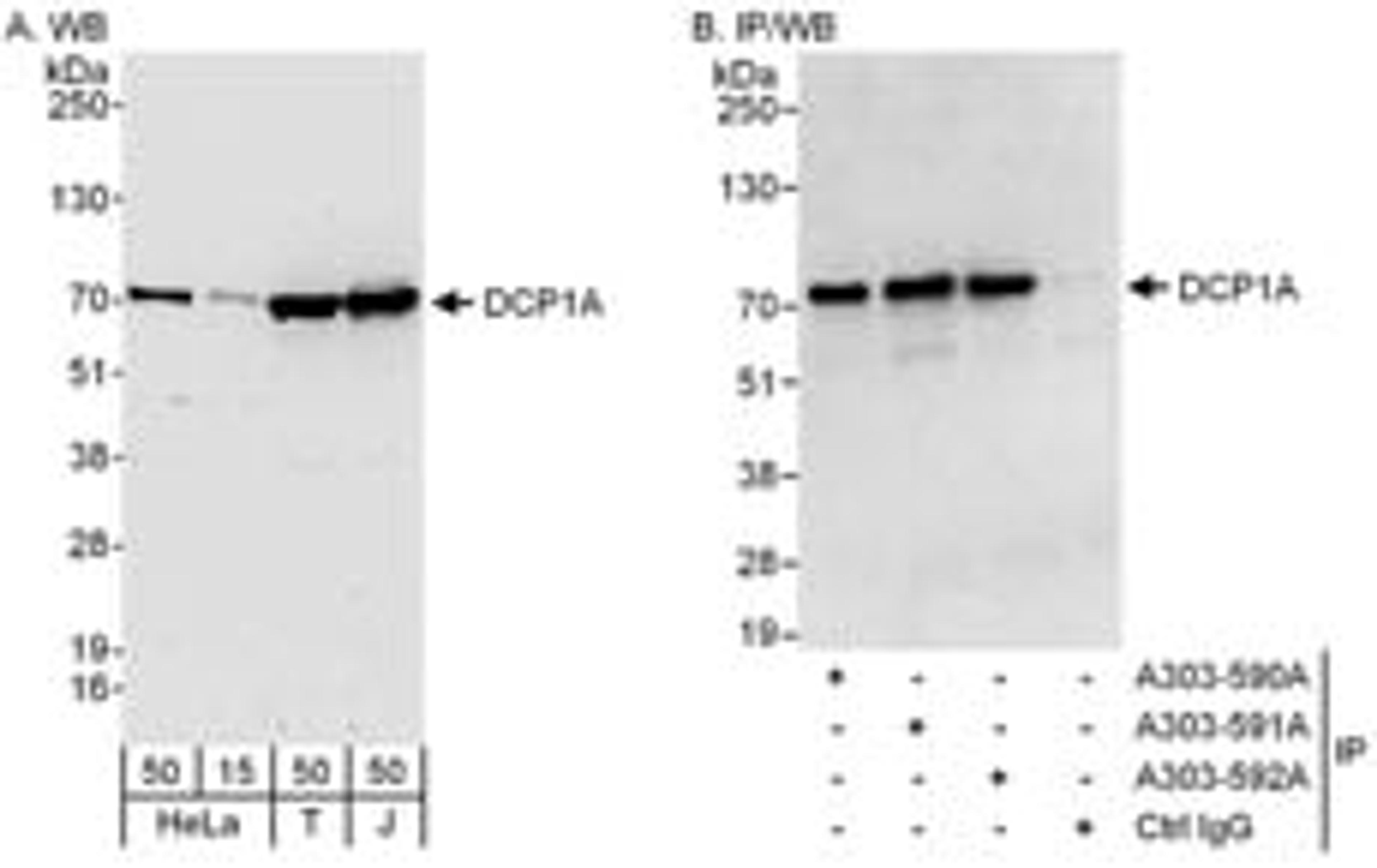 Detection of human DCP1A by western blot and immunoprecipitation.