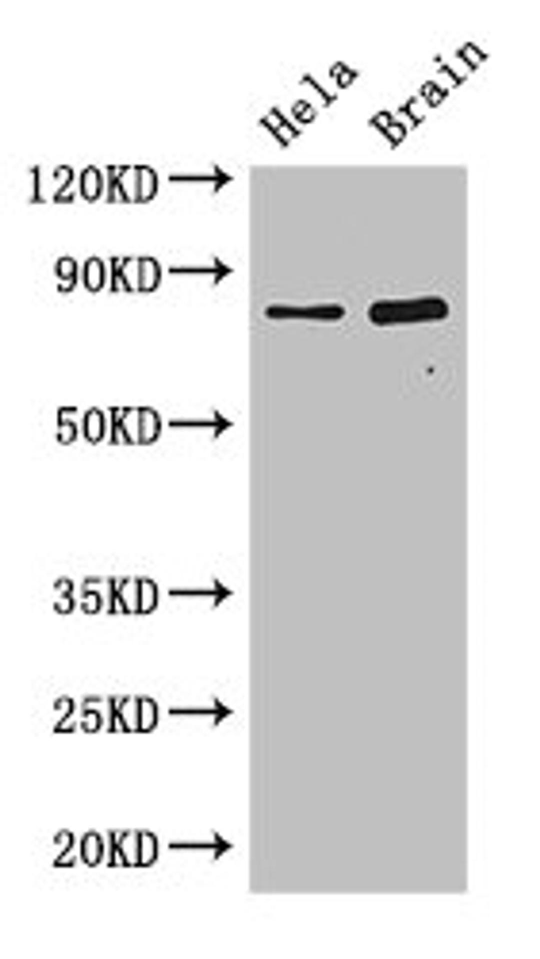 Western Blot. Positive WB detected in: Hela whole cell lysate, Mouse brain tissue. All lanes: DACH1 antibody at 2.8ug/ml. Secondary. Goat polyclonal to rabbit IgG at 1/50000 dilution. Predicted band size: 47, 12 kDa. Observed band size: 79 kDa.