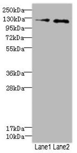 Western blot. All lanes: HEPH antibody at 2.49ug/ml. Lane 1: HepG2 whole cell lysate. Lane 2: Jurkat whole cell lysate. Secondary. Goat polyclonal to rabbit IgG at 1/10000 dilution. Predicted band size: 131, 137, 101 kDa. Observed band size: 131 kDa. 