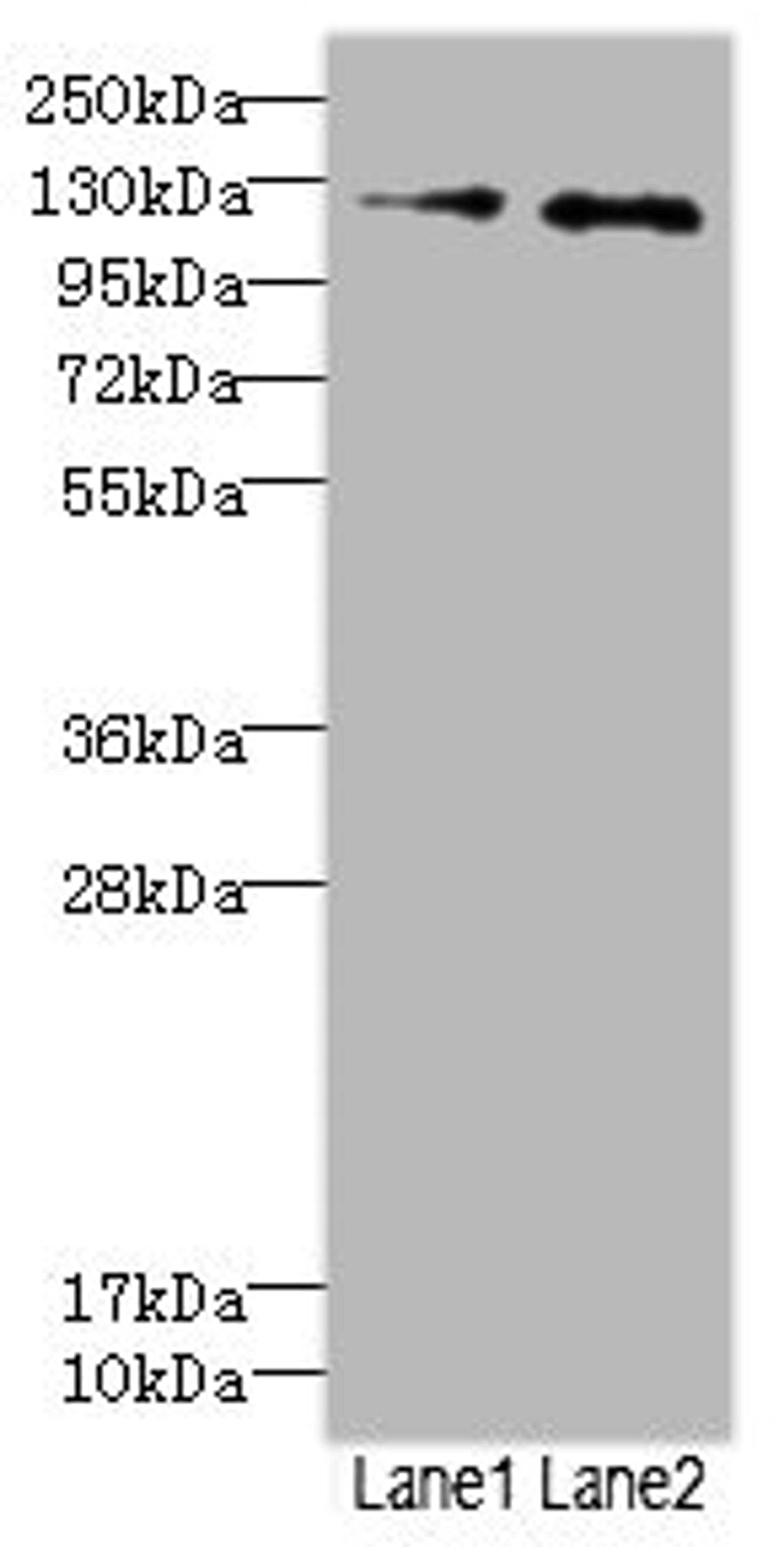 Western blot. All lanes: HEPH antibody at 2.49ug/ml. Lane 1: HepG2 whole cell lysate. Lane 2: Jurkat whole cell lysate. Secondary. Goat polyclonal to rabbit IgG at 1/10000 dilution. Predicted band size: 131, 137, 101 kDa. Observed band size: 131 kDa. 