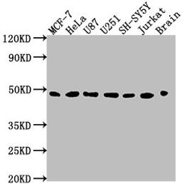 Western Blot. Positive WB detected in: MCF-7 whole cell lysate, HeLa whole cell lysate, U87 whole cell lysate, U251 whole cell lysate, SH-SY5Y whole cell lysate, Jurkat whole cell lysate, Rat brain tissue. All lanes: LOX antibody at 1:2000. Secondary. Goat polyclonal to rabbit IgG at 1/50000 dilution. Predicted band size: 47 kDa. Observed band size: 47 kDa.