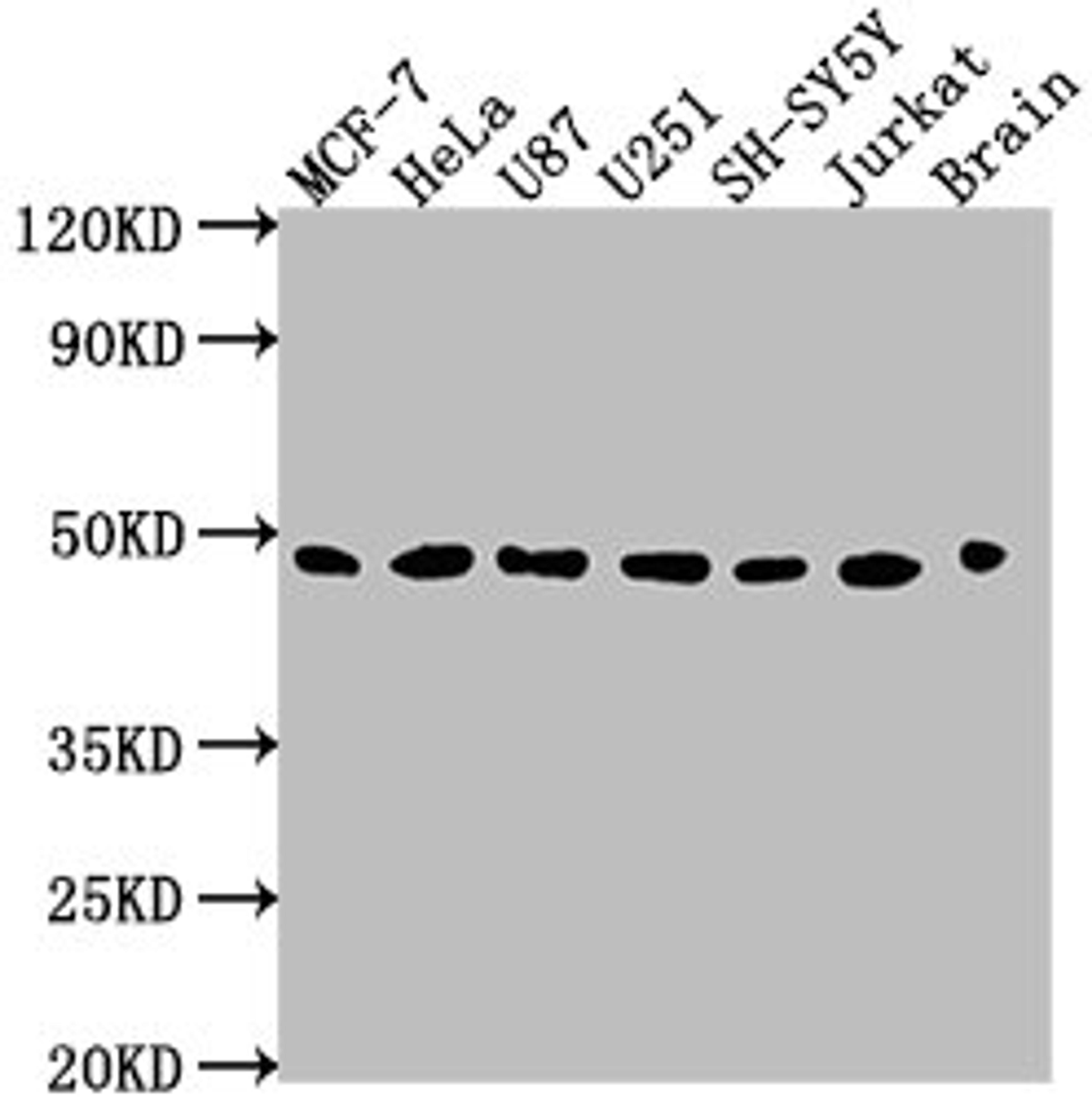Western Blot. Positive WB detected in: MCF-7 whole cell lysate, HeLa whole cell lysate, U87 whole cell lysate, U251 whole cell lysate, SH-SY5Y whole cell lysate, Jurkat whole cell lysate, Rat brain tissue. All lanes: LOX antibody at 1:2000. Secondary. Goat polyclonal to rabbit IgG at 1/50000 dilution. Predicted band size: 47 kDa. Observed band size: 47 kDa.