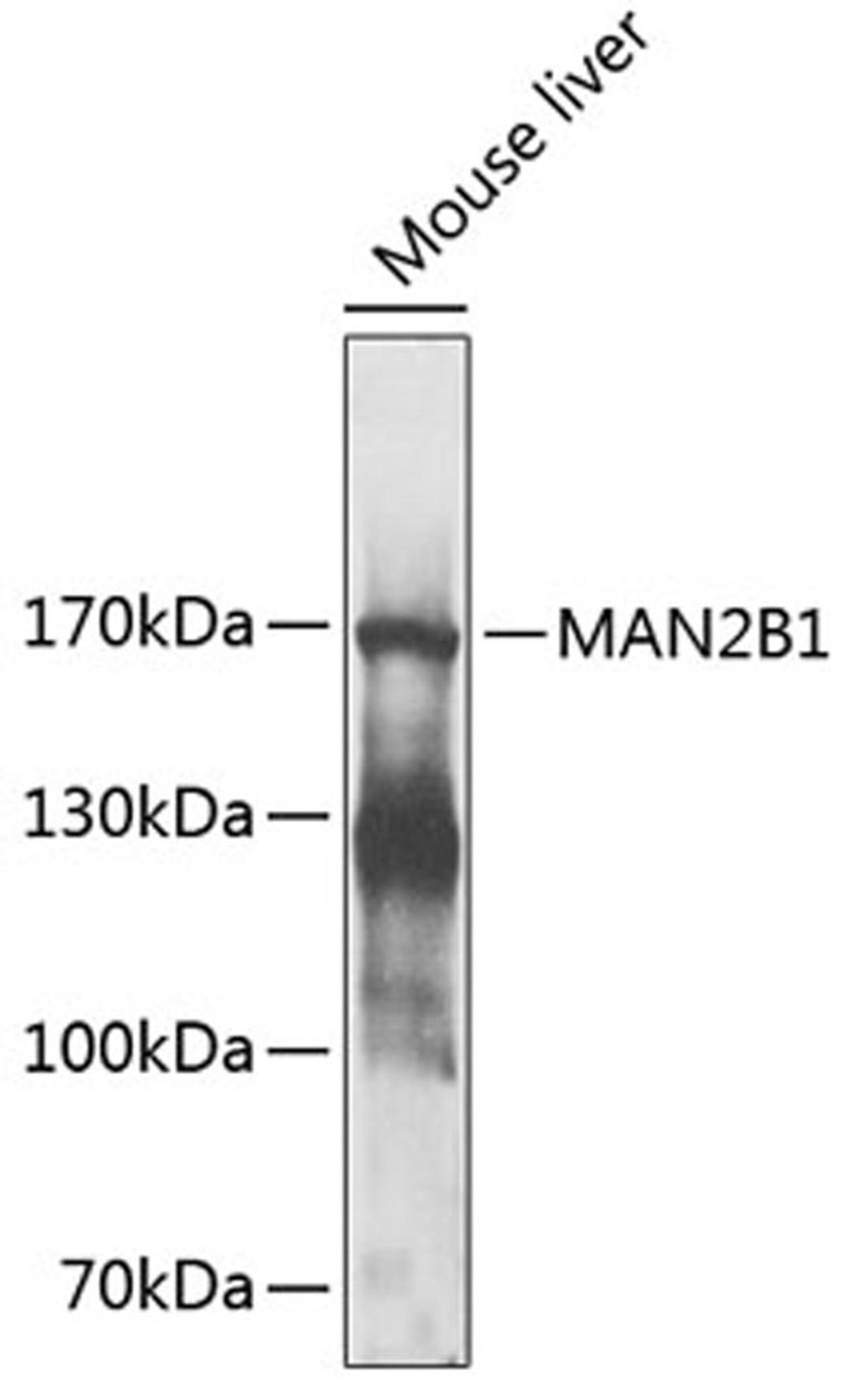 Western blot - MAN2B1 antibody (A9937)