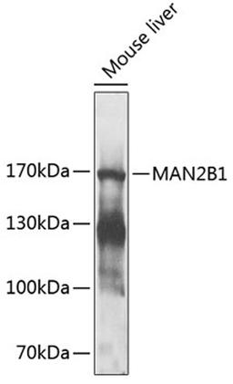 Western blot - MAN2B1 antibody (A9937)