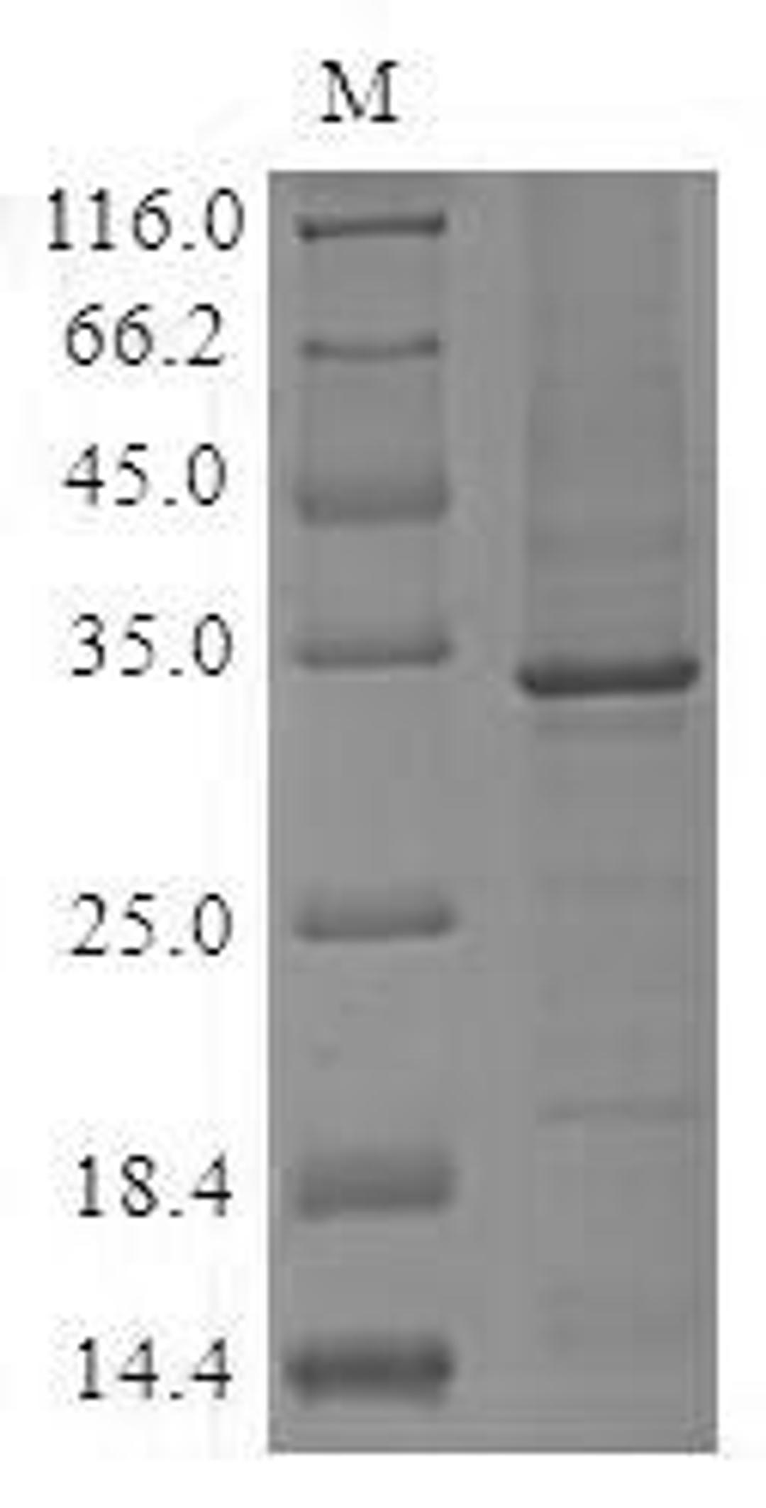 (Tris-Glycine gel) Discontinuous SDS-PAGE (reduced) with 5% enrichment gel and 15% separation gel.
