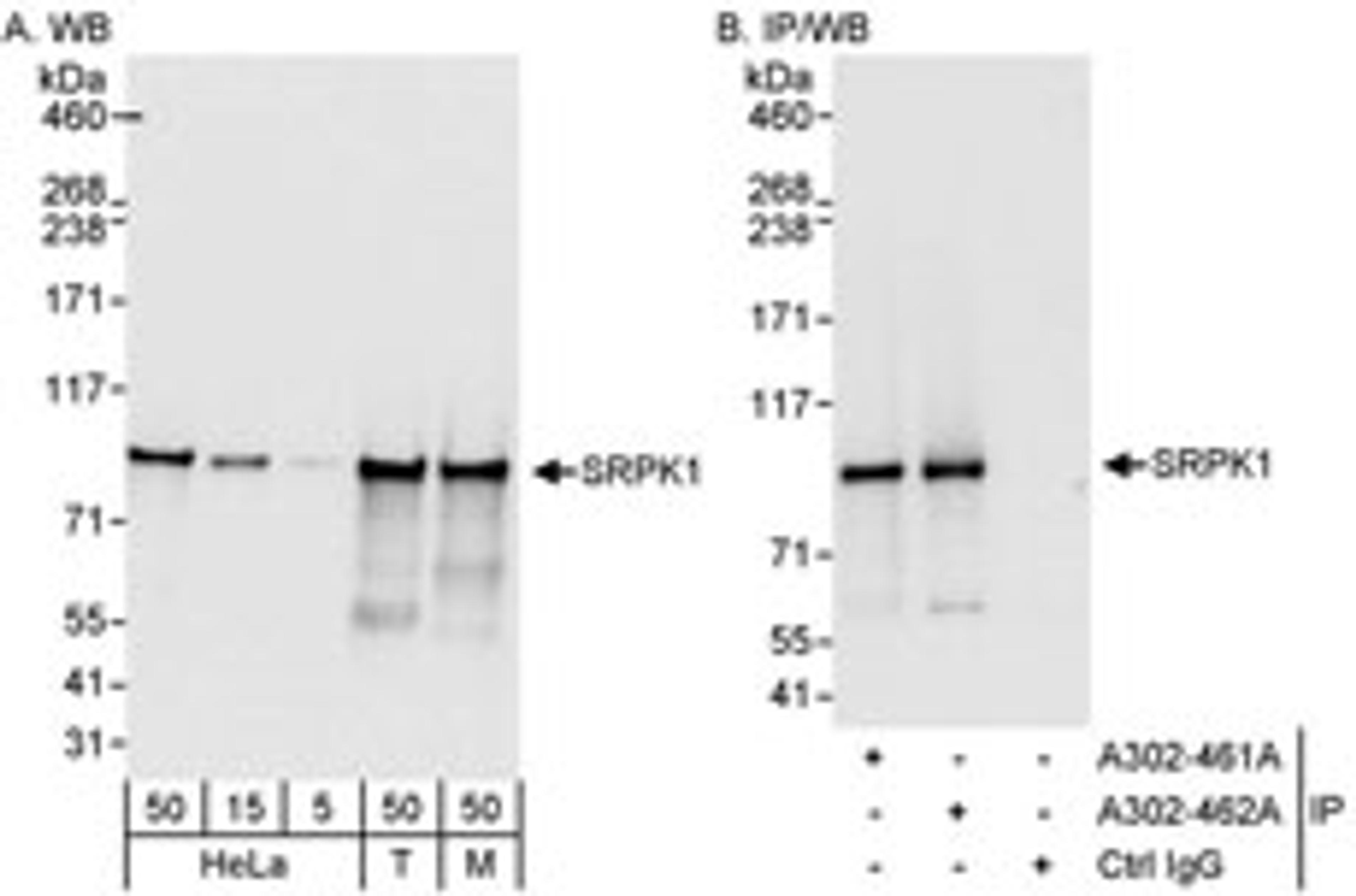 Detection of human and mouse SRPK1 by western blot (h & m) and immunoprecipitation (h).