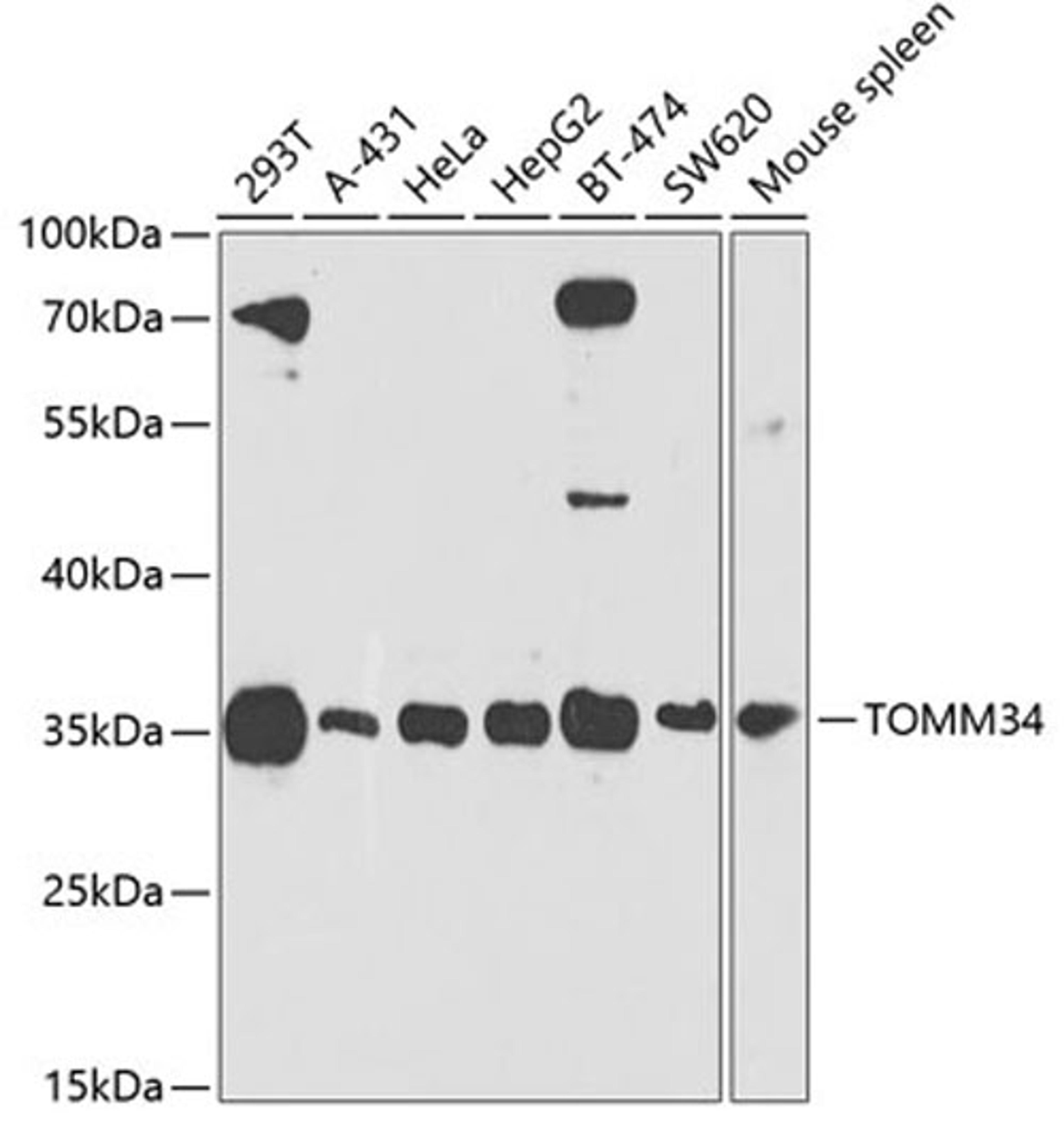 Western blot - TOMM34 antibody (A4467)