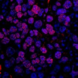 Detection of human FUSIP1 by immunohistochemistry.