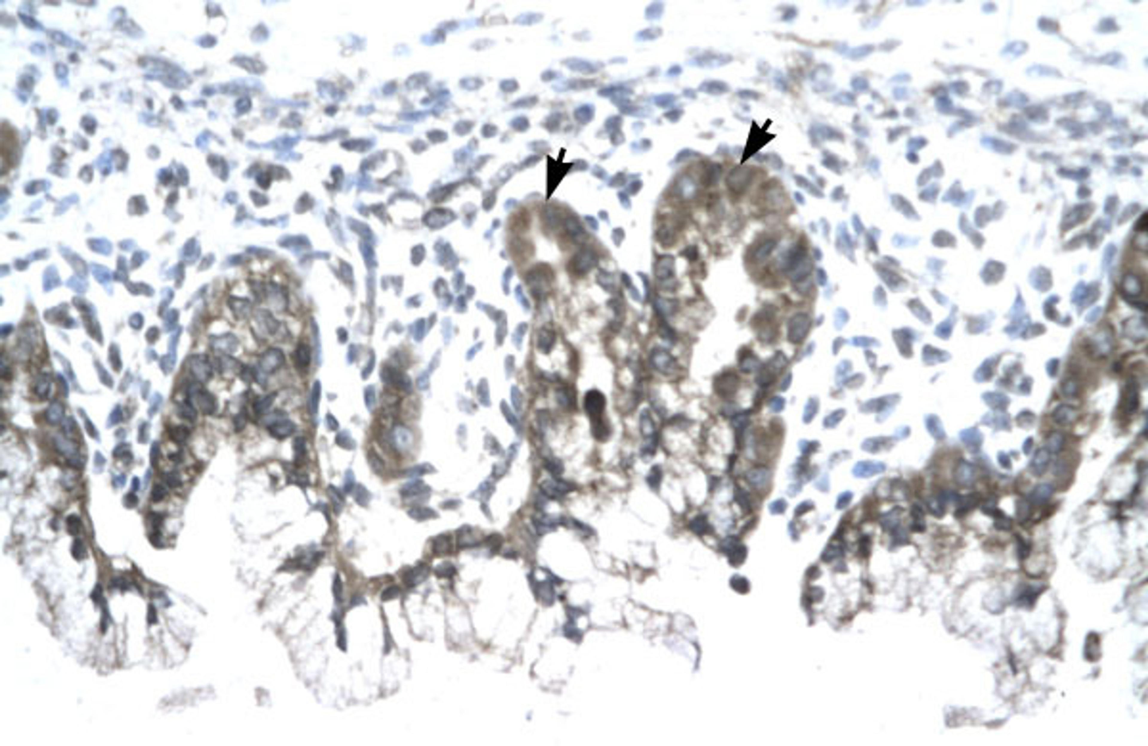 Antibody used in IHC on Human Stomach.